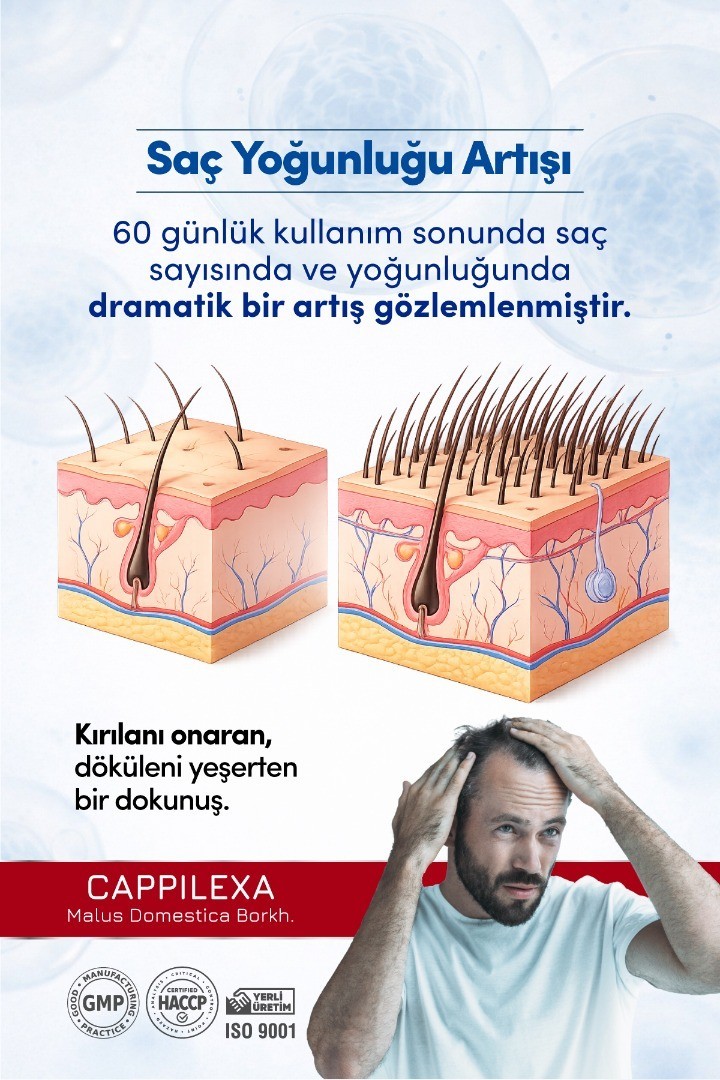 Cappilexa Annurca Elma Ekstresi - 4